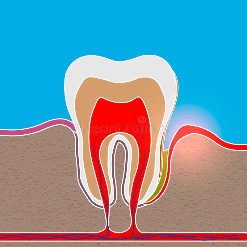 What if 🦷🦷🦷 decay had nothing to do with your teeth?
What if