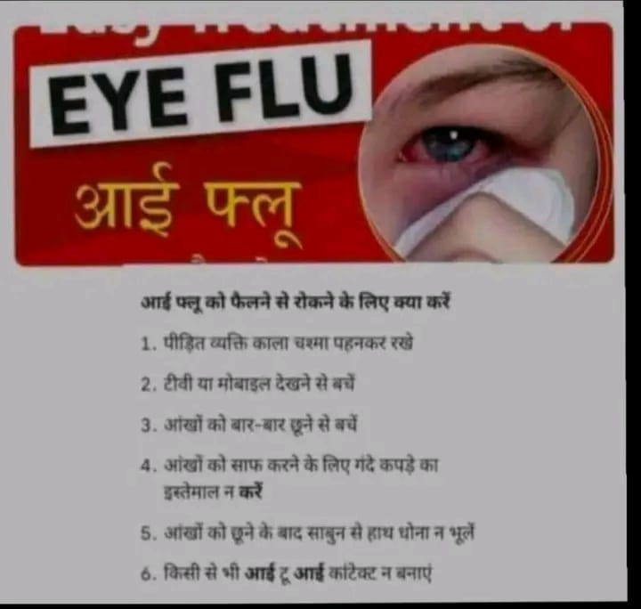 eye flu