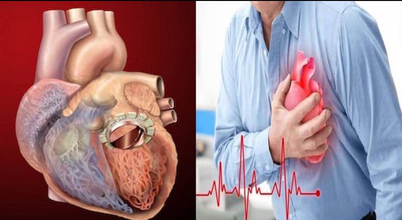 Heart Attack Symptoms Before 2 Days: Before the heart attack
