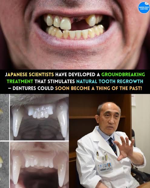 Can you regrow your teeth? Japanese scientist develop world'