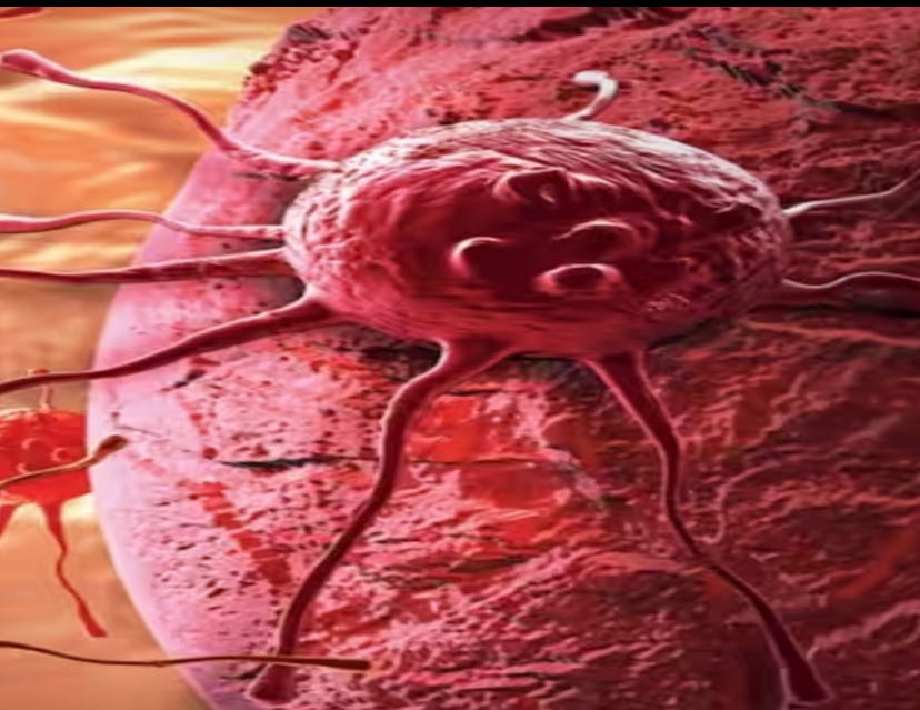 Cancer symptoms can vary according to the person's body and 